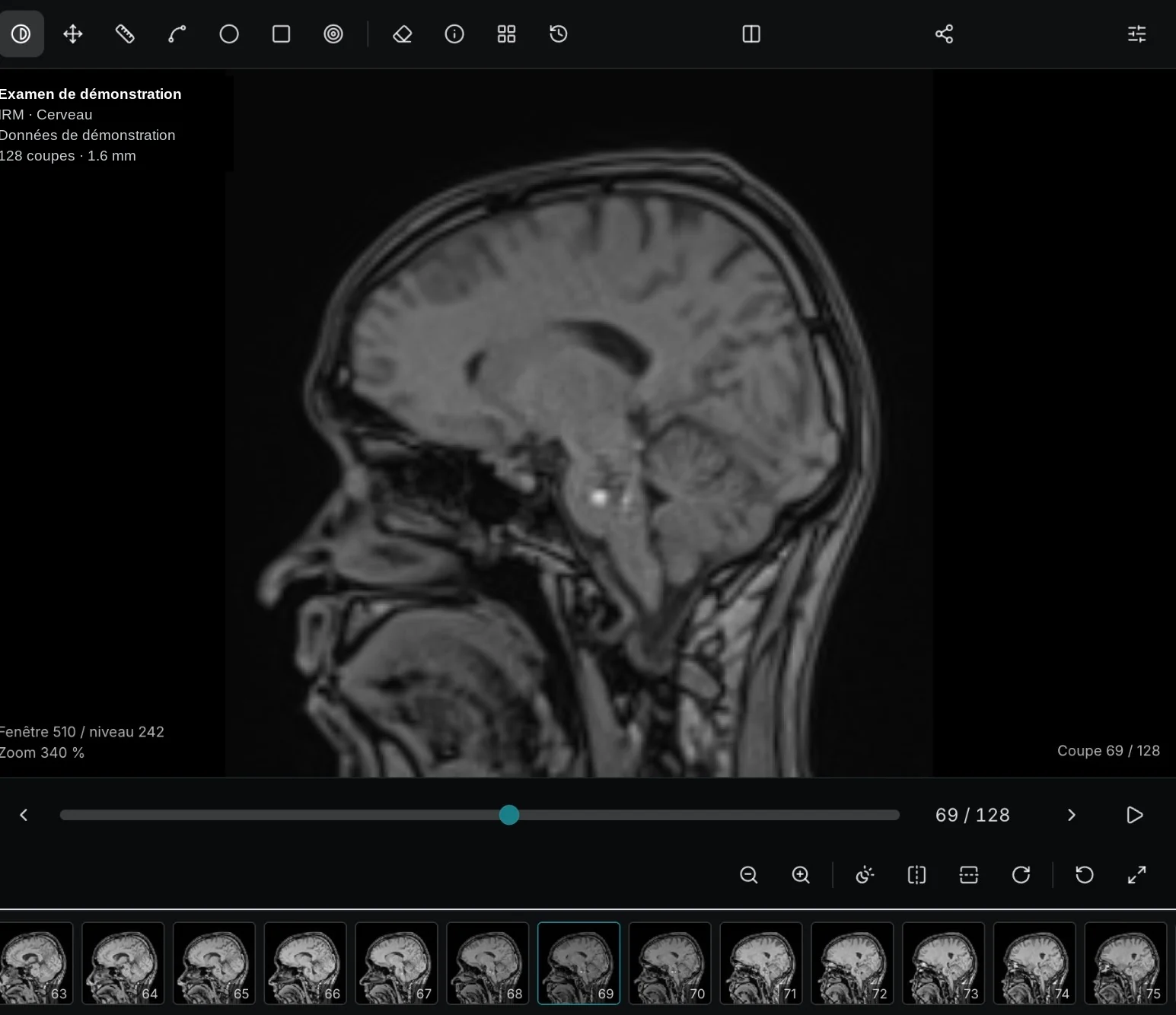 scans.me viewer showing a demonstration brain MRI with tools and slice strip